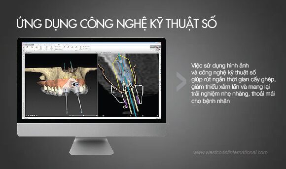 Ứng Dụng Công Nghệ Kỹ Thuật Số